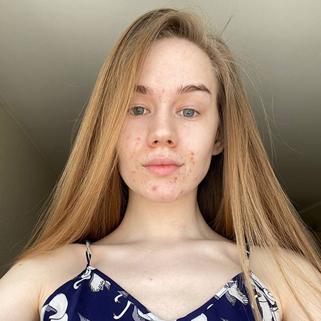 Нижнее фото